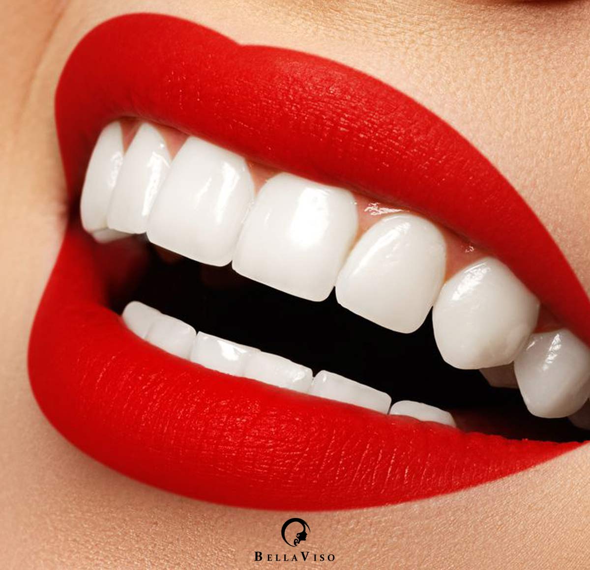 best Porcelain veneers Cost in dubai