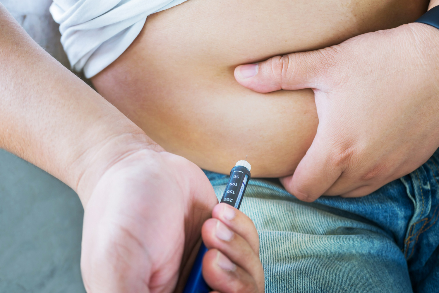 semaglutide in weight management